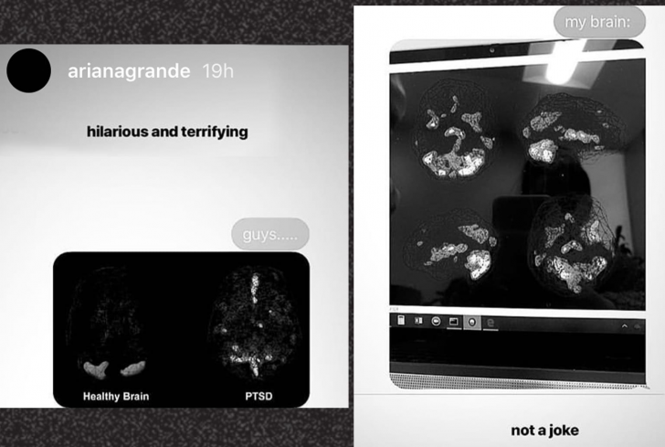 Grande commented her CT scan revealed the hilarious yet terrifying PTSD levels her brain has.