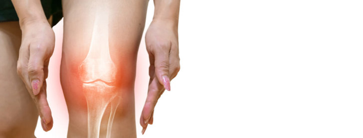 osteoarthritis-1